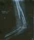 X-ray